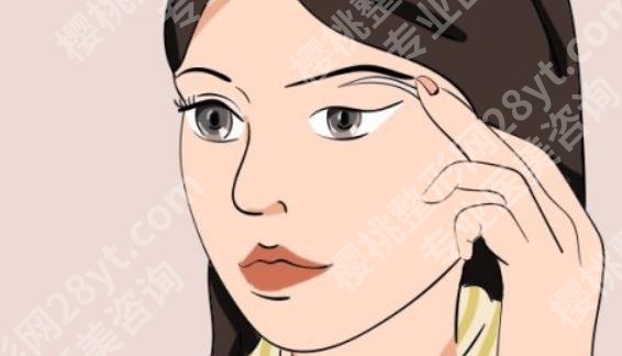 成都心悦容医疗美容医院医生介绍!真实案例分享!价格预览!