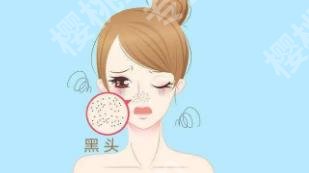 牙膏去黑头有用吗?科普知识介绍!一看便知!