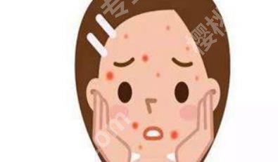 脸上长痘痘怎么去除?3种方法介绍!一看便知!
