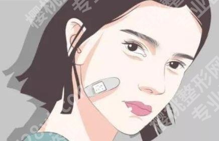 脸上有疤痕怎么办?多种方法推荐!价格介绍!