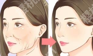 黄寅守拉皮案例介绍!医院背景介绍!价格表汇总!