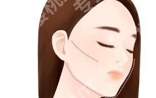黄寅守拉皮案例介绍!医院背景介绍!价格表汇总!