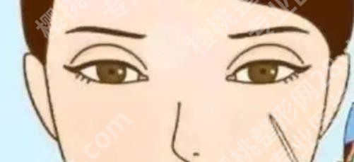 复丽医疗美容做双眼皮怎么样?医院医生北京介绍!价格表汇总!
