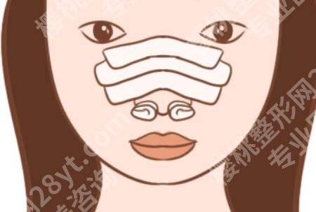 北京丽星翼美医疗美容整形医院怎么样?真实案例分享!价格预览!