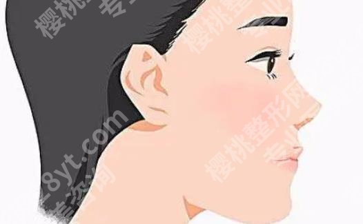 北京沃尔医疗美容医院怎么样?坐诊医生技术介绍!热门项目公开!