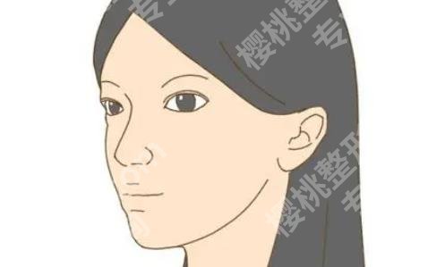 上海港华做鼻综合怎么样?2位医生介绍!案例分享!
