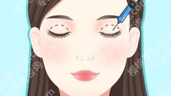 北京十优医疗美容门诊部做眼睛怎么样?医生优势介绍!案例分享!