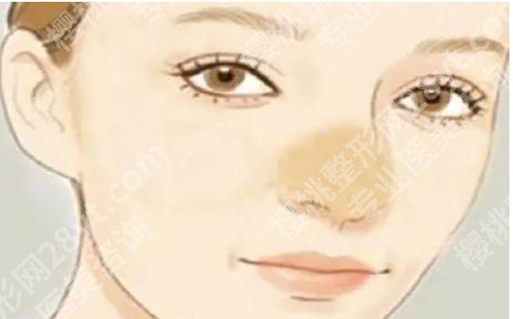 北京仁慈医疗美容门诊部怎么样?院内热门项目介绍!一起看看吧!