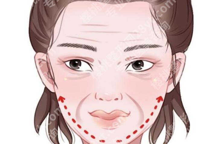 北京张红芳医生怎么样?真实案例分享!价格预览!
