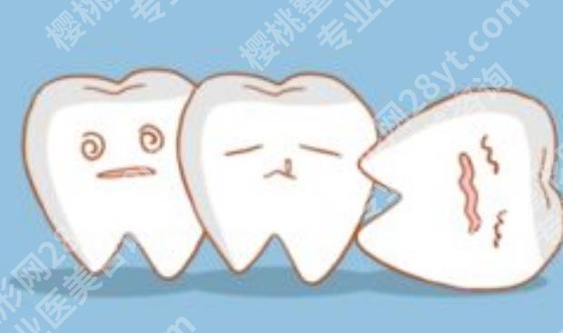 牙齿松动是什么原因?多种原因介绍!赶紧看看吧!