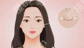 北京沃尔赵丹做鼻子怎么样?医院以及医生介绍!价格预览!