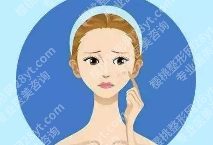 欧洲之星是激光还是光波?项目详细介绍!术前必看!