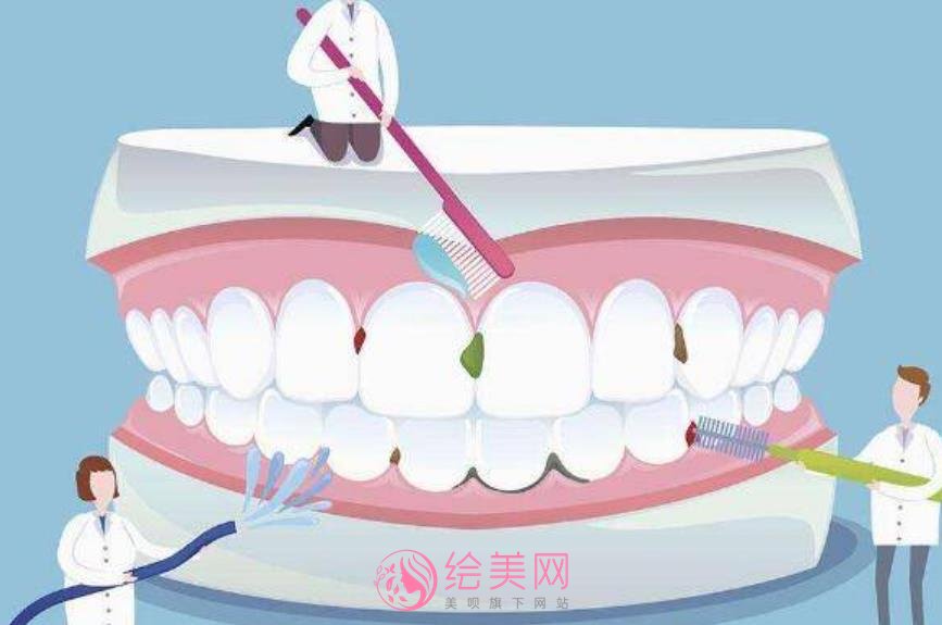小苏打如何美白牙齿?牙齿美白的医疗方式有哪些?