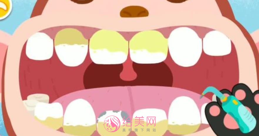 小苏打如何美白牙齿?牙齿美白的医疗方式有哪些?