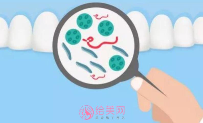 小苏打如何美白牙齿?牙齿美白的医疗方式有哪些?