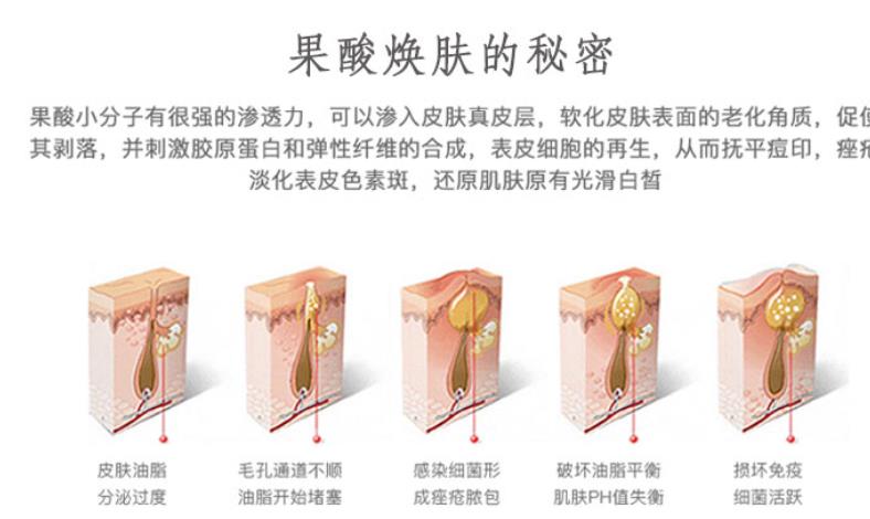 果酸换肤有用么?做几次才有果?附注意事项
