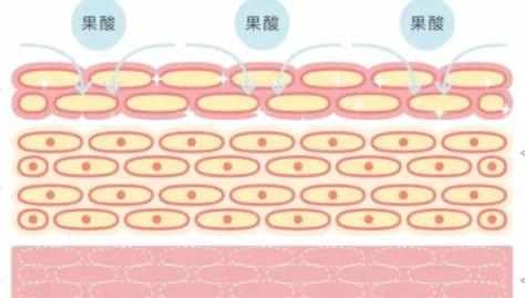 果酸换肤有用么?做几次才有果?附注意事项