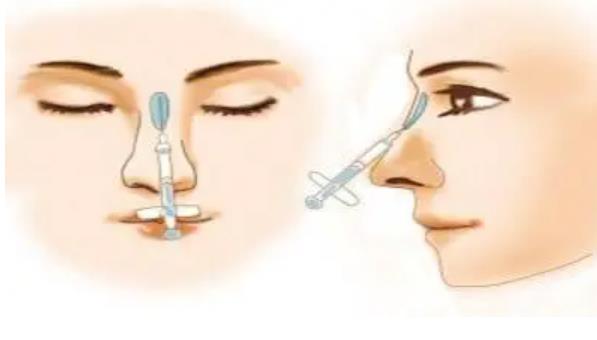 隆鼻手术危险吗？隆鼻手术选择那种材质好？注射v假体那种更可靠？