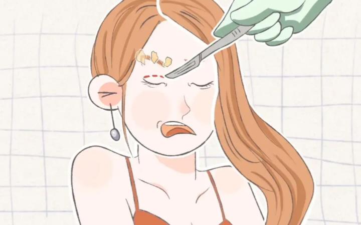 美杜莎双眼皮是怎么样的?来看看真人做眼部整形对比图吧