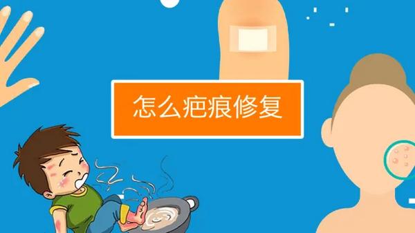 selina烧伤情况怎么样?疤痕产生如何修复?