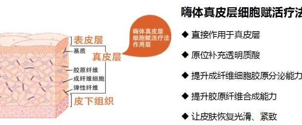 嗨体注射脖子除皱的果好不好?能维持多久?注意事项分享
