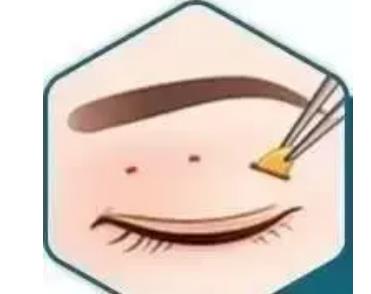 眼部吸脂手术的价格是多少?手术前后注意事项有哪些?