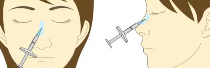 注射胶原蛋白隆鼻怎么样?鼻部整形注意事项分享!会不会有什么危害
