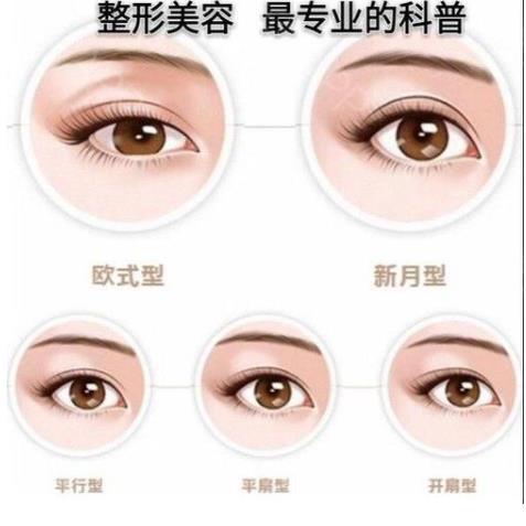 西安唯星颜医疗美容怎么样?埋线双眼皮的优点是什么?精选案例分享