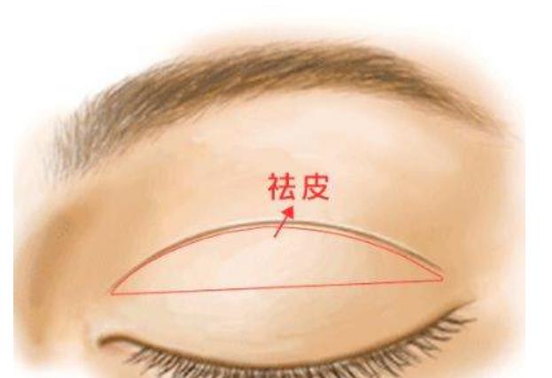 西安汉唐传承做双眼皮怎么样?精选眼部整形案例来袭!