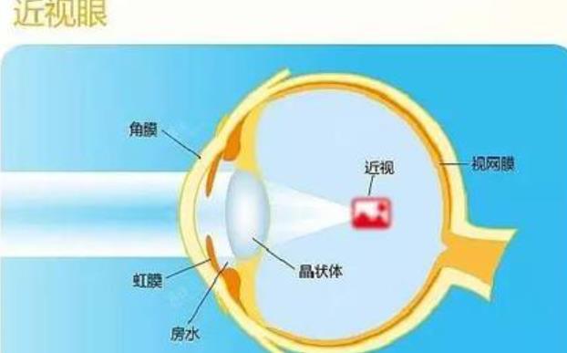 黔东南州人民医院眼科怎么样?李刚医生个人资料介绍!近视眼调节对比图分享
