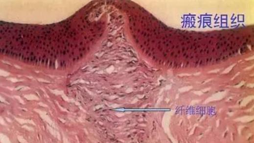 泰州人民医院整形美容科怎么样?孙步梅医生资料介绍!疤痕修复案例