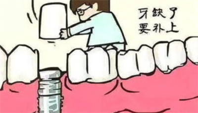 老人全口牙齿多少钱一副?价格足够昂贵吗?