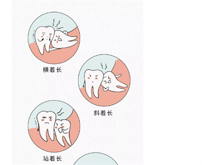 正畸牙齿年龄限制?不要错过佳时间哟!