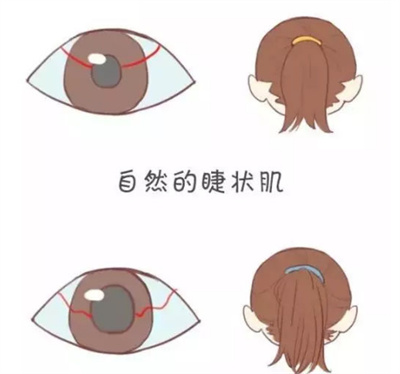 激光手术调节近视眼多少度可做?近视者的福音