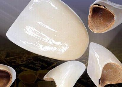 钛合金烤瓷牙的寿命是多少?怎样正确使用呢?
