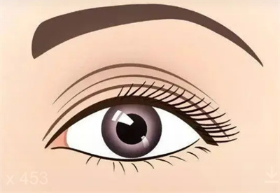 眼部整容手术有哪些？上睑下垂也能做重睑术吗？