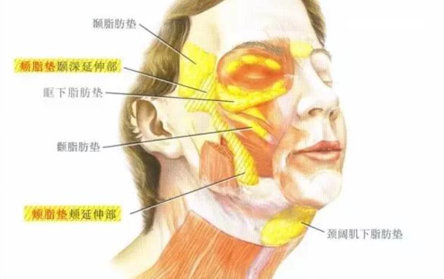 去颊脂垫手术有副作用吗?颊脂垫手部位是哪里?手术过程需要注意什么