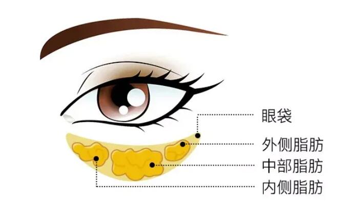 南昌鹏爱整形美容医院怎么样?真实案例分享:七天完成突变!