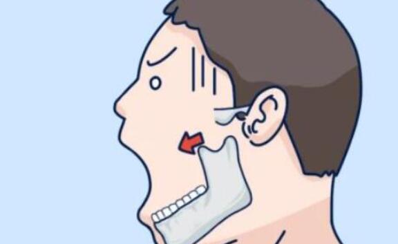 女人后缩下颌角整形效果好不好?有什么注意事项吗?