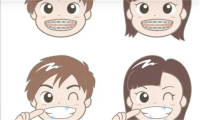 上海拜尔口腔门诊部牙齿矫正案例分享~真人测评不容错过
