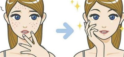 彩光嫩肤有什么副作用吗?光子嫩肤的技术特点有哪些?