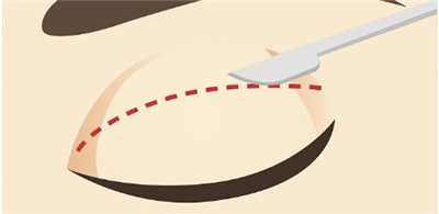 侣同帅和杨亚益谁的双眼皮修复技术好?两位是李医生简介!