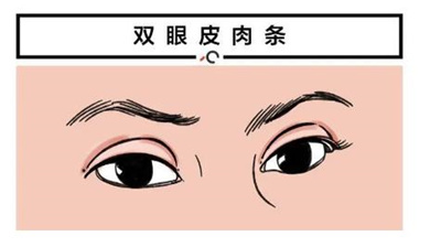 侣同帅和杨亚益谁的双眼皮修复技术好?两位是李医生简介!