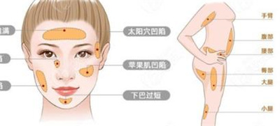脂肪填充脸部有什么副作用?脂肪填充可以维持多久时间?