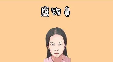 怎样改良鹰钩鼻子?做矫正术手术有没有用?手术前后注意事项分享