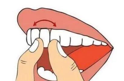 牙齿松动是什么原因?有什么解决方法吗?