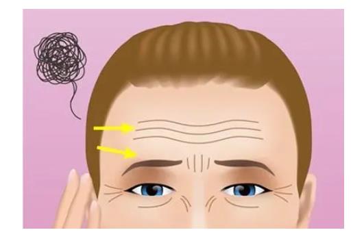 怎样减少眼部皱纹?眼部皱纹形成的原因有哪些?类型有这几种!
