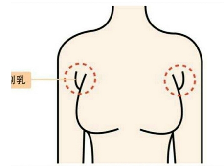 协和医院朱琳副乳手术风格如何?科室|医生信息介绍~副乳手术案例公布!