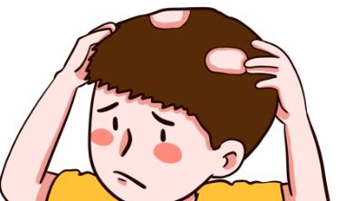 调节斑秃的土方法有哪些?不懂的集美戳进来吧