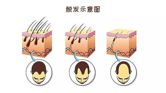 网上爆火的一月生发液怎么样?防脱育发液真的有用吗?脱发姐妹收藏~